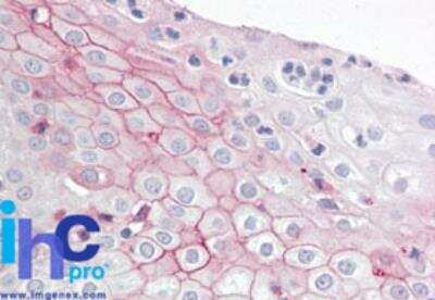 Immunohistochemistry-Paraffin: ZBTB2 Antibody [NBP2-24660]