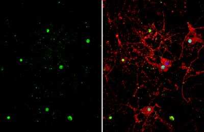 Immunocytochemistry/ Immunofluorescence: ZBTB20 Antibody [NBP2-20936]