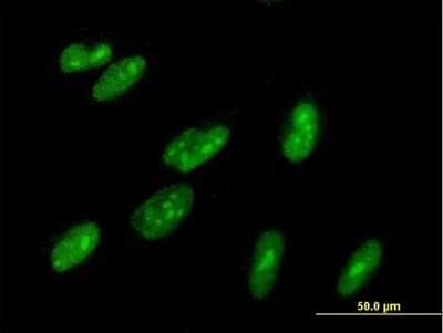 Immunocytochemistry/ Immunofluorescence: ZBTB22 Antibody [H00009278-B01P]