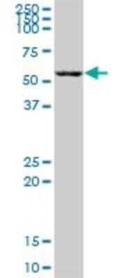 Western Blot: ZBTB22 Antibody [H00009278-B01P]