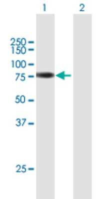 Western Blot: ZBTB22 Antibody [H00009278-B01P]