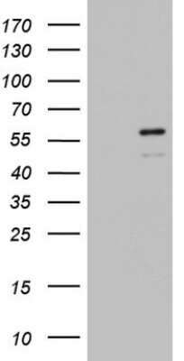 Western Blot: ZBTB37 Antibody (OTI1D7) [NBP2-46396]