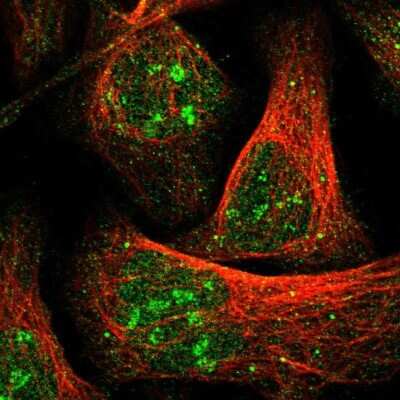 Immunocytochemistry/ Immunofluorescence: ZBTB37 Antibody [NBP1-81151]