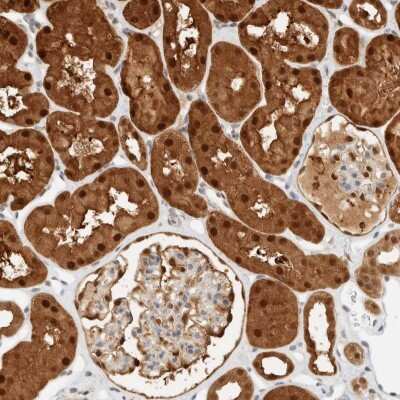 Immunohistochemistry-Paraffin: ZBTB37 Antibody [NBP1-81151]