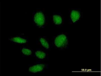 Immunocytochemistry/ Immunofluorescence: ZBTB39 Antibody [H00009880-B01P]