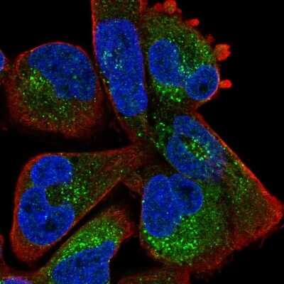 Immunocytochemistry/ Immunofluorescence: ZBTB39 Antibody [NBP2-13535]