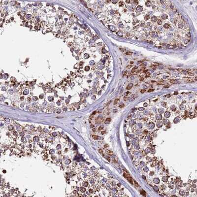 Immunohistochemistry-Paraffin: ZBTB39 Antibody [NBP2-13534]