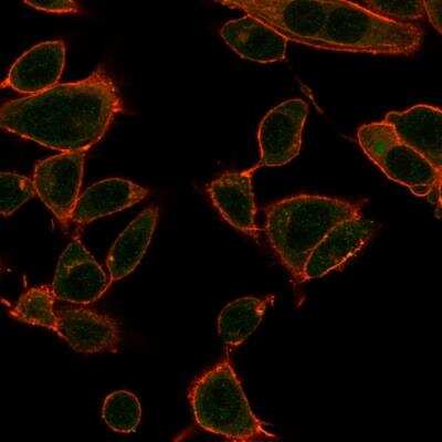 Immunocytochemistry/ Immunofluorescence: ZBTB39 Antibody (PCRP-ZBTB39-1A11) [NBP3-07478]