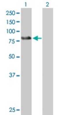 Western Blot: ZBTB39 Antibody [H00009880-B01P]