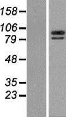 Western Blot: ZBTB39 Overexpression Lysate [NBP2-07276]