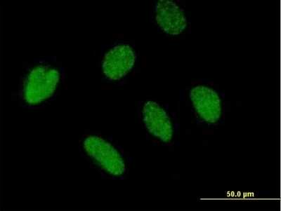 Immunocytochemistry/ Immunofluorescence: ZBTB46 Antibody [H00140685-B01P]