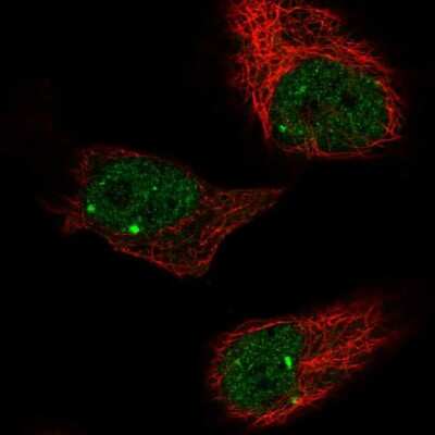 Immunocytochemistry/ Immunofluorescence: ZBTB5 Antibody [NBP2-13536]