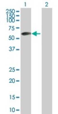Western Blot: ZBTB6 Antibody [H00010773-B01P]