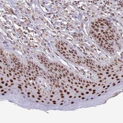 Immunohistochemistry-Paraffin: ZBTB7A/Pokemon Antibody [NBP2-38550]