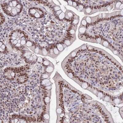Immunohistochemistry-Paraffin: ZBTB7A/Pokemon Antibody [NBP2-38550]