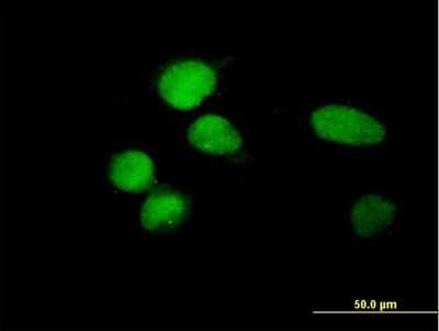 Immunocytochemistry/ Immunofluorescence: ZBTB8A Antibody [H00653121-B01P]