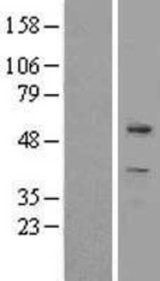 Western Blot: ZBTB8A Overexpression Lysate [NBL1-17979]
