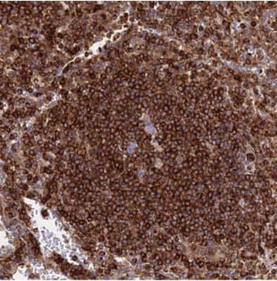 Immunohistochemistry: ZBTB8OS Antibody [NBP2-30455]