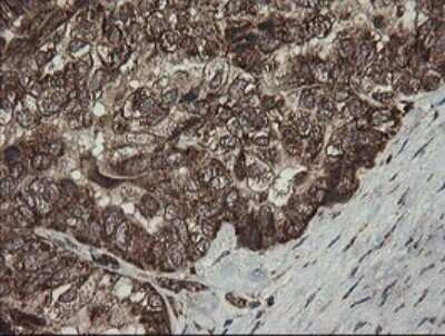Immunohistochemistry: CGI 62 Antibody (OTI4C1) [NBP2-45700]