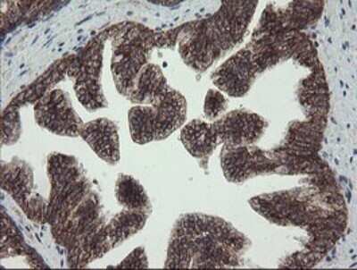 Immunohistochemistry: CGI 62 Antibody (OTI4C1) [NBP2-45700]