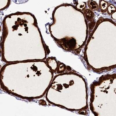 Immunohistochemistry: ZC3H12C Antibody [NBP2-48695]