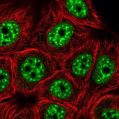 Immunocytochemistry/ Immunofluorescence: ZC3H14 Antibody [NBP2-13537]