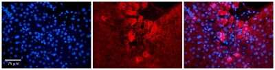Immunohistochemistry: ZC3H14 Antibody [NBP1-56914]