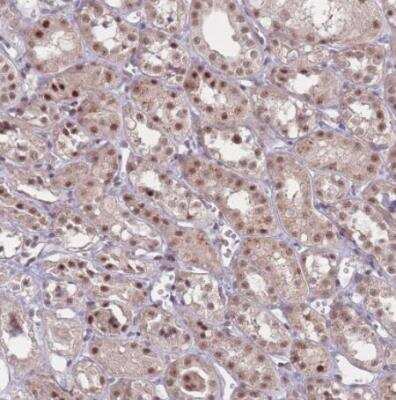 Immunohistochemistry-Paraffin: ZC3H14 Antibody [NBP2-13537]