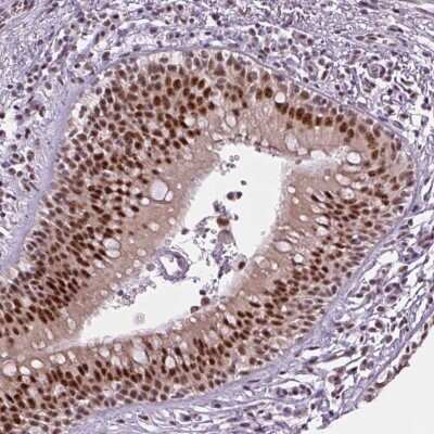 Immunohistochemistry-Paraffin: ZC3H14 Antibody [NBP2-49087]