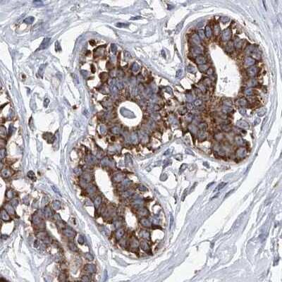 Immunohistochemistry-Paraffin: ZC3H15 Antibody [NBP1-81312]