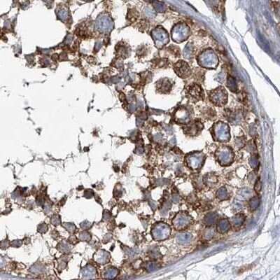 Immunohistochemistry-Paraffin: ZC3H15 Antibody [NBP1-81312]