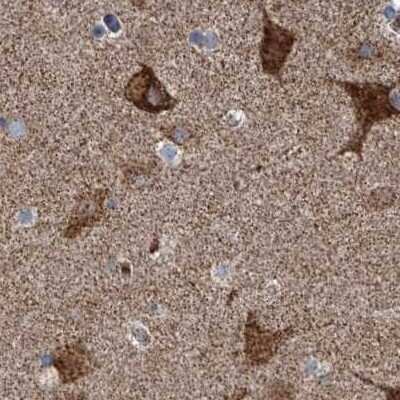 Immunohistochemistry-Paraffin: ZC3H15 Antibody [NBP1-81312]