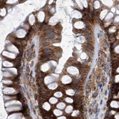 Immunohistochemistry-Paraffin: ZC3H15 Antibody [NBP1-81312]