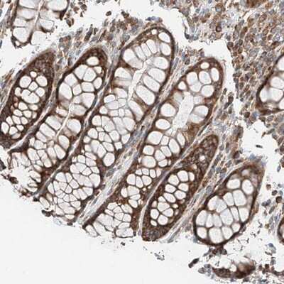 Immunohistochemistry-Paraffin: ZC3H15 Antibody [NBP1-81314]