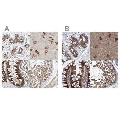 Immunohistochemistry-Paraffin: ZC3H15 Antibody [NBP1-81314]
