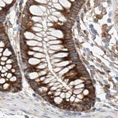 Immunohistochemistry-Paraffin: ZC3H15 Antibody [NBP1-81314]