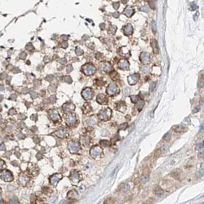 Immunohistochemistry-Paraffin: ZC3H15 Antibody [NBP1-81314]
