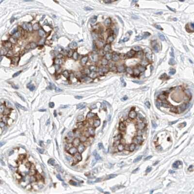 Immunohistochemistry-Paraffin: ZC3H15 Antibody [NBP1-81314]
