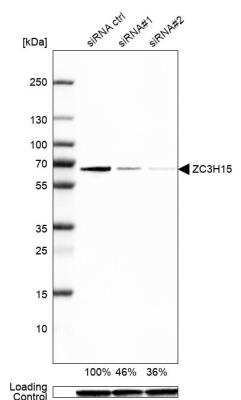Western Blot: ZC3H15 Antibody [NBP1-81312]