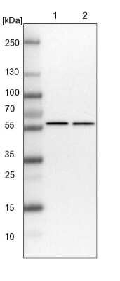 Western Blot: ZC3H15 Antibody [NBP1-81314]
