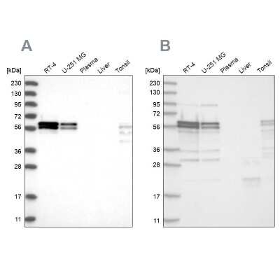Western Blot: ZC3H15 Antibody [NBP1-81314]