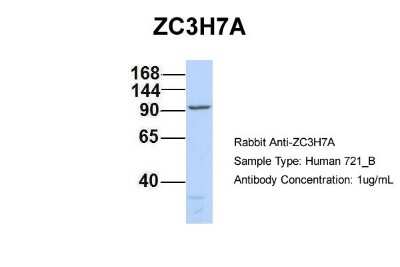 Western Blot: ZC3H7A Antibody [NBP1-79987]