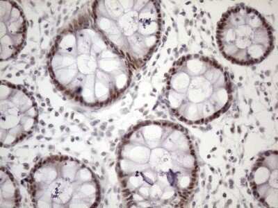 Immunohistochemistry: ZC3H8 Antibody (OTI4H5) [NBP2-46397]
