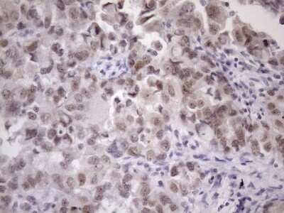 Immunohistochemistry: ZC3H8 Antibody (OTI4H5) [NBP2-46397]