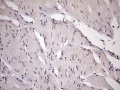 Immunohistochemistry: ZC3H8 Antibody (OTI4H5) [NBP2-46397]