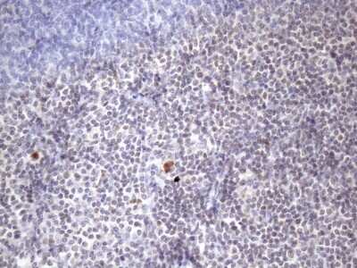 Immunohistochemistry: ZC3H8 Antibody (OTI4H5) [NBP2-46397]