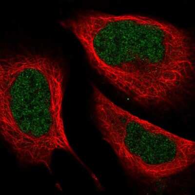 Immunocytochemistry/ Immunofluorescence: ZC3H8 Antibody [NBP2-33980]