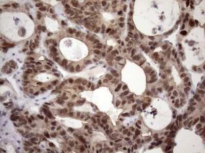 Immunohistochemistry: ZC3H8 Antibody (OTI4H5) - Azide and BSA Free [NBP2-74908]