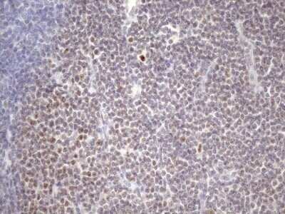 Immunohistochemistry: ZC3H8 Antibody (OTI4H5) - Azide and BSA Free [NBP2-74908]