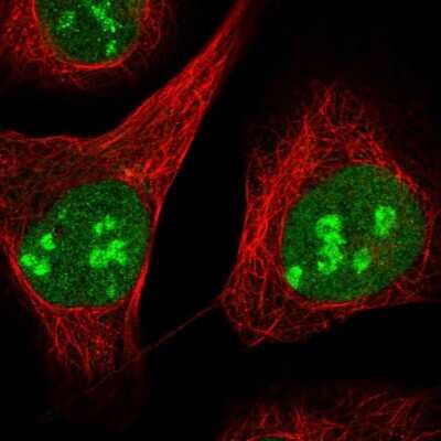 Immunocytochemistry/ Immunofluorescence: ZCCHC10 Antibody [NBP1-82206]